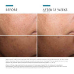 Discoloration Defense