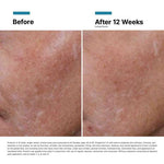 Hyaluronic Acid Intensifier Multi-Glycan