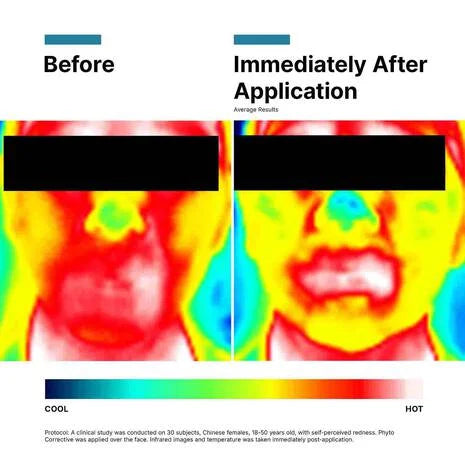 Phyto Corrective Gel