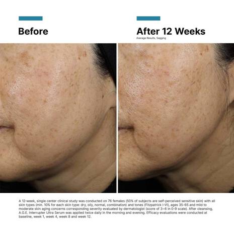 A.G.E. Interrupter Ultra Serum