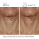 Tripeptide-R Neck Repair